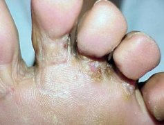 1_120802142911_1_lit.jpg