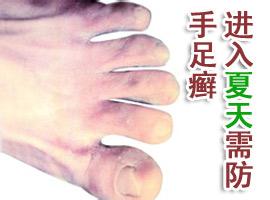 u=2898312385,316565433&fm=23&gp=0.jpg